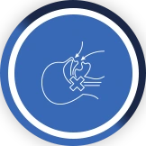 Sleep Apnea